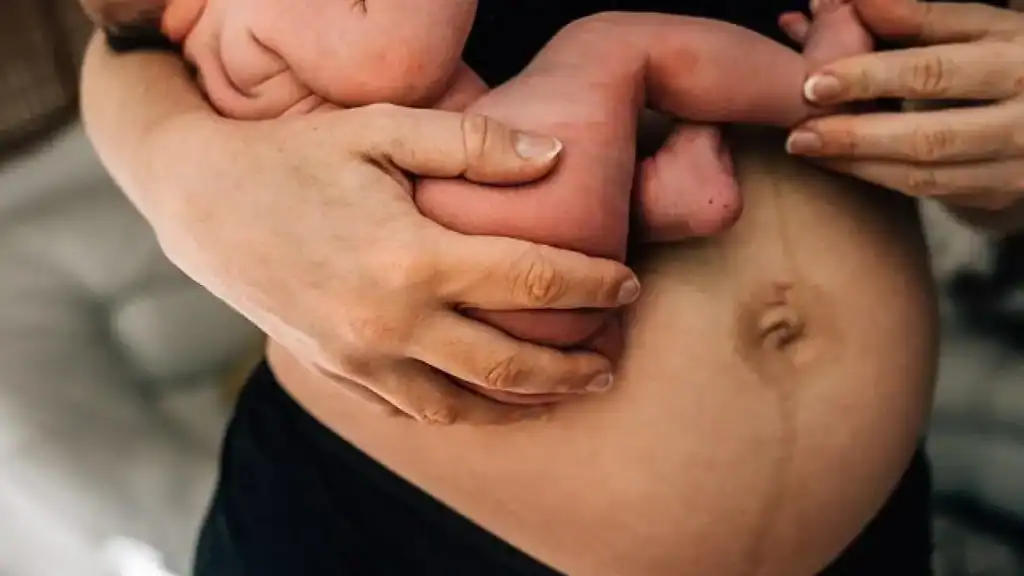 Why Is My Stomach Still Big After Pregnancy Glasgow?